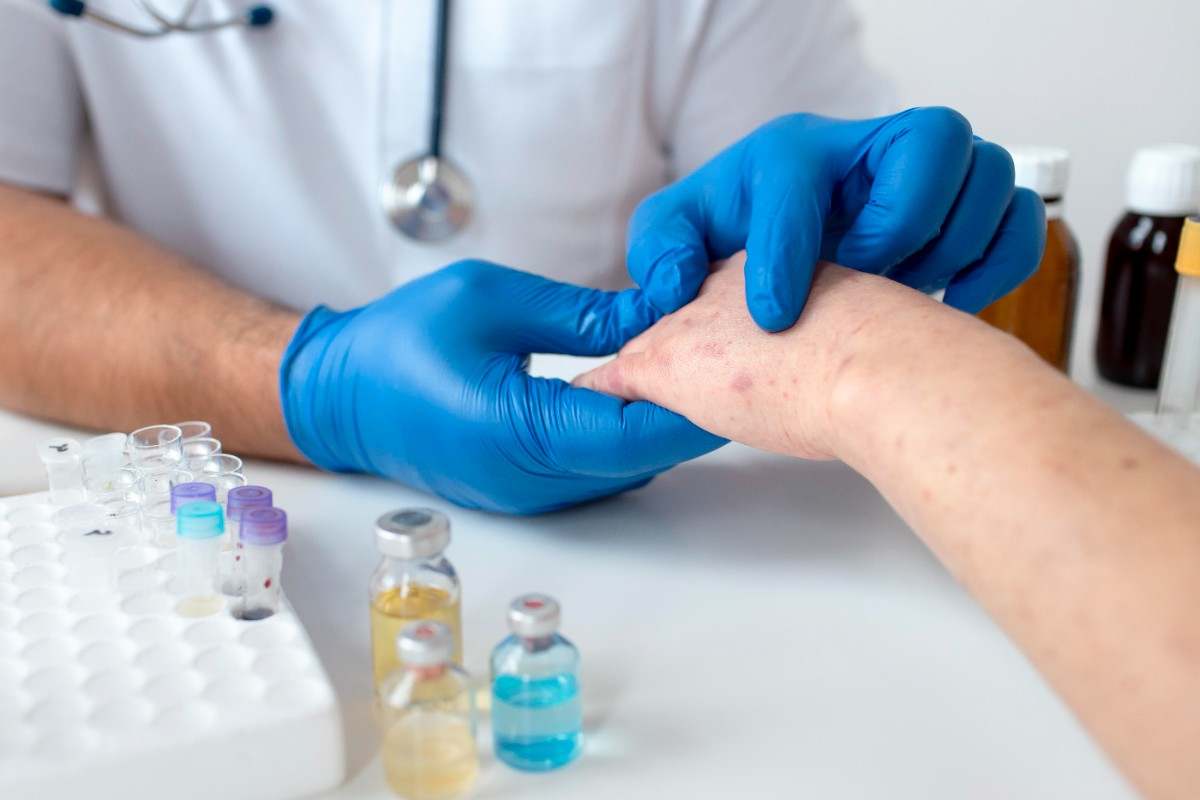 Fungal Infection Treatment
