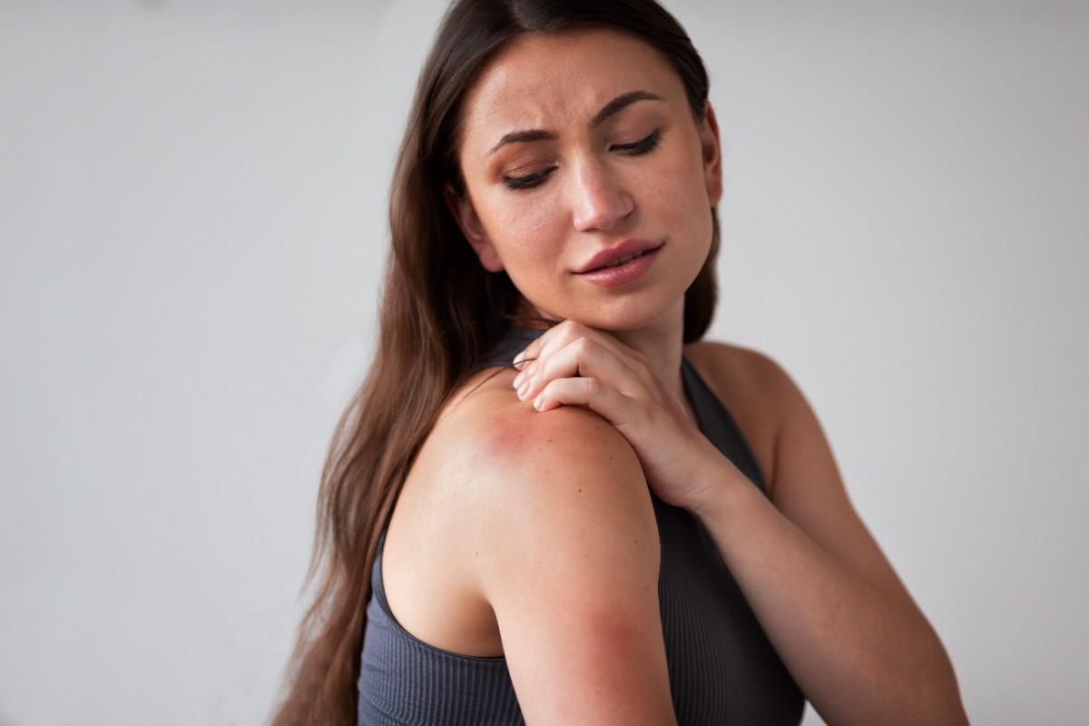 Skin Allergy & Sensitivity